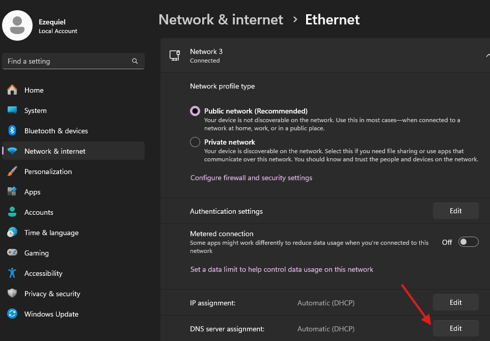 Find The Option Called DNS Server Assignment And Click The Edit Button
